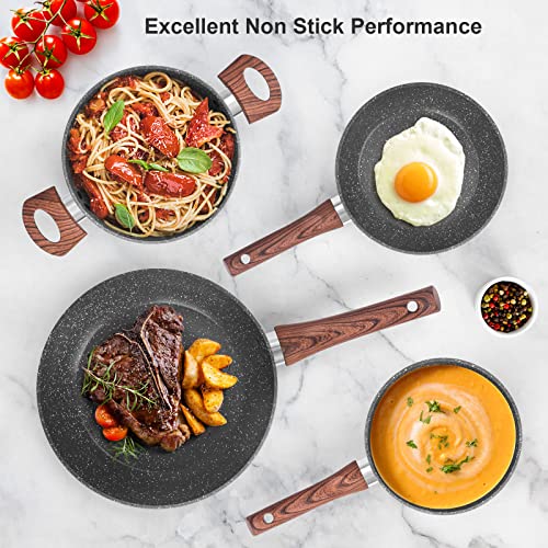 Pots and Pans Set Non Stick